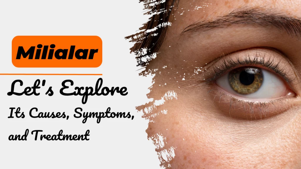 Milialar: Let's Explore Its Causes, Symptoms, and Treatment